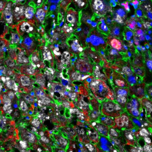 Cellular regeneration therapy restores damaged liver tissue faster than ever