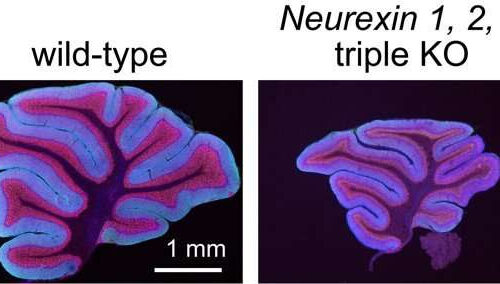 Neurexin controls cerebellar granule cells, offering insight into autism, schizophrenia mechanisms