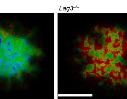 Illumination of immune checkpoint LAG3 ‘black box’ could yield new cancer and autoimmune therapies