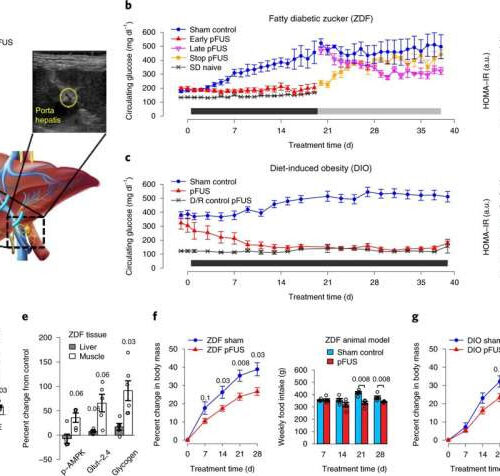 Treating diabetes without drugs? Novel non-pharmacologic treatments are on the horizon