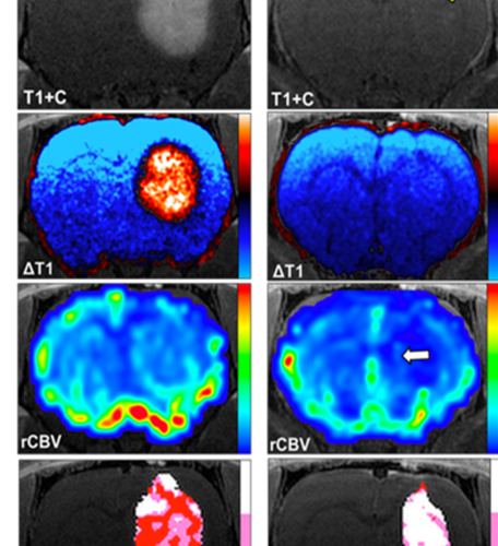 Innovative therapy that “tricks” and destroys cancer cells advances to clinical trial