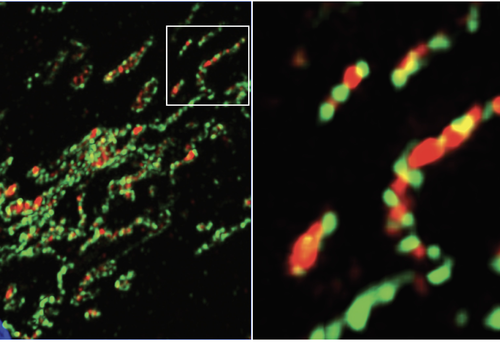 Balancing lipids and recycling to prevent mitochondrial meltdown