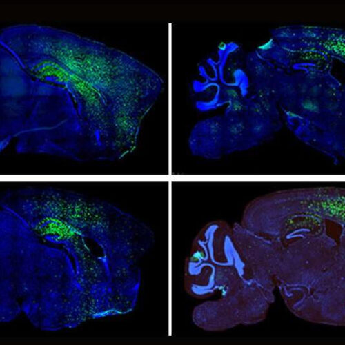 Some autism spectrum disorder symptoms linked to astrocytes