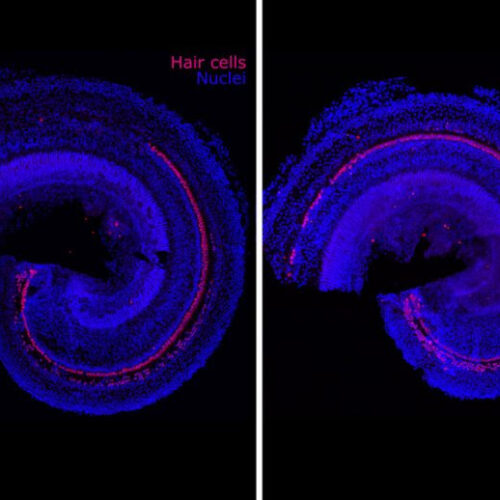 MIT Scientists Develop New Regenerative Drug That Reverses Hearing Loss