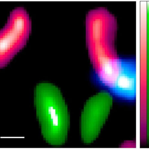 Researchers adapt technology made for astronomical observations to biomedical imaging