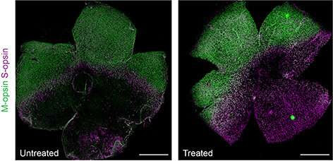 New study suggests base editing may be an effective one-time, durable treatment for inherited retinal degeneration