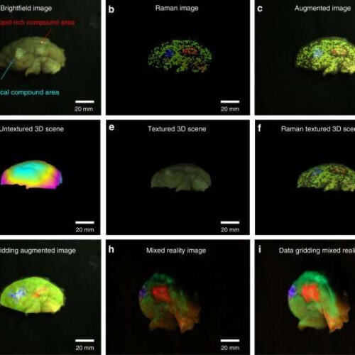 Real-time molecular imaging of near-surface tissue using Raman spectroscopy