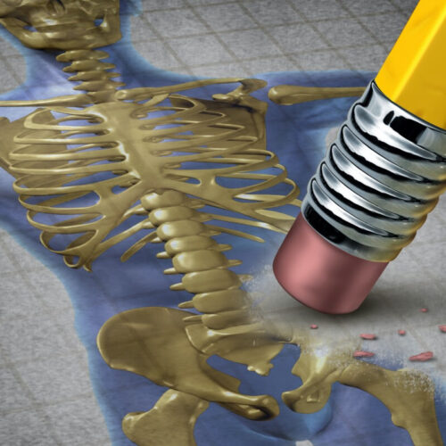 Naturally occurring hormone could offer a better osteoporosis treatment