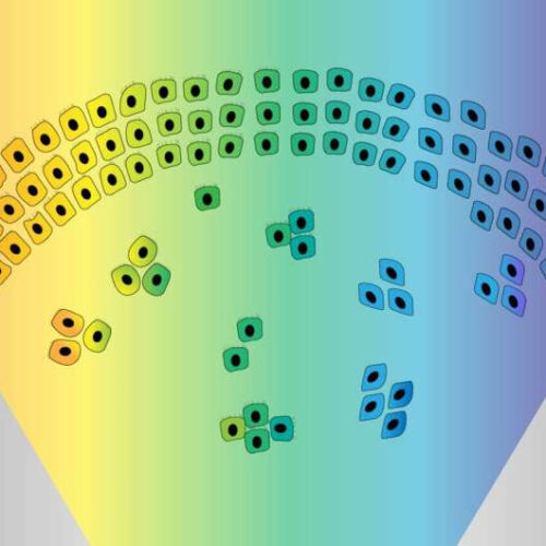 New insights into the mechanisms that enable cancer cells to metastasize