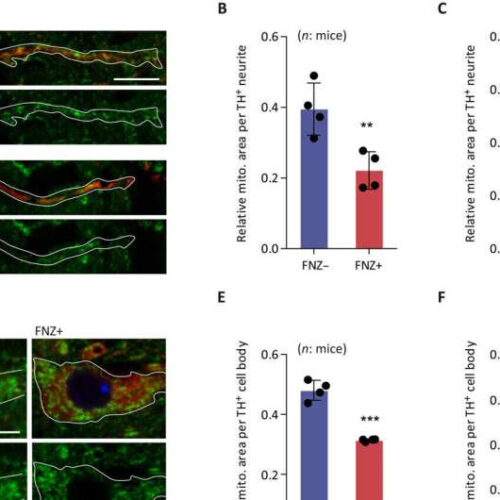 Newly discovered mechanism points to cause of drug-induced parkinsonism