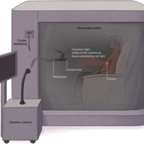 A Cerenkov luminescence imaging device to help spot cancerous tumors