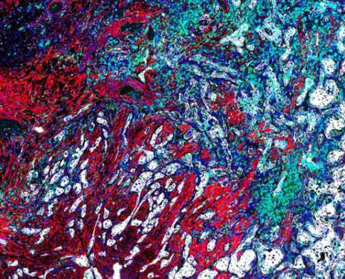 A new tool makes high-resolution imaging data on human tissues easier to understand and use