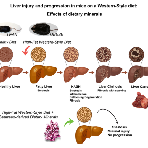 Mineral supplement could stop fatty liver disease progression