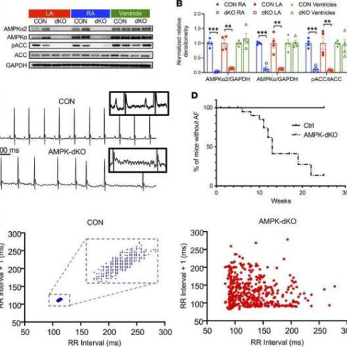 The role of metabolic signaling in preventing atrial fibrillation