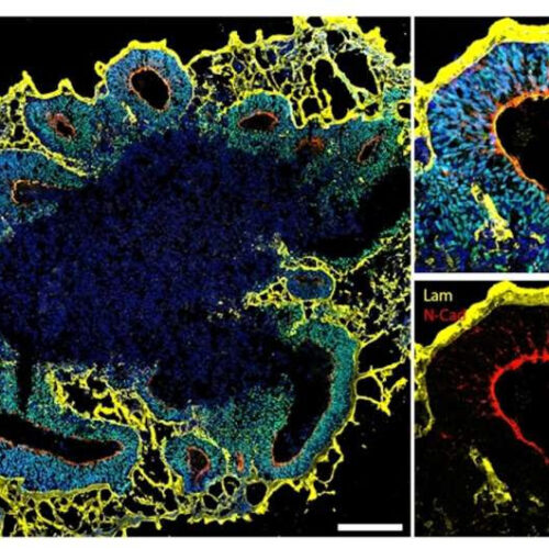 Miniature brain models help our understanding of autism