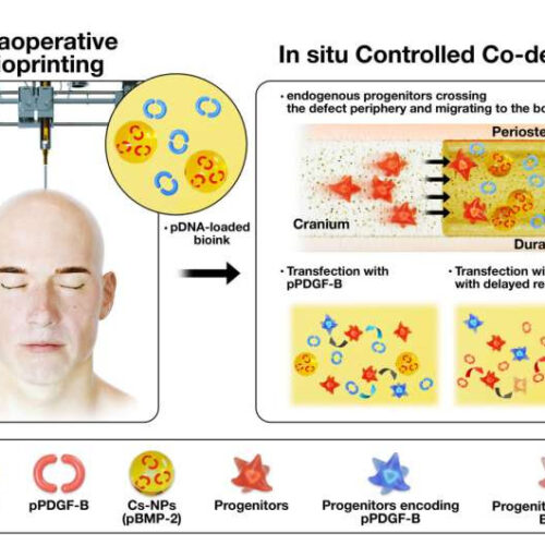 Bioprinting for bone repair improved with gene therapy