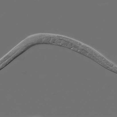 What a tiny, wiggling worm can teach us about cancer