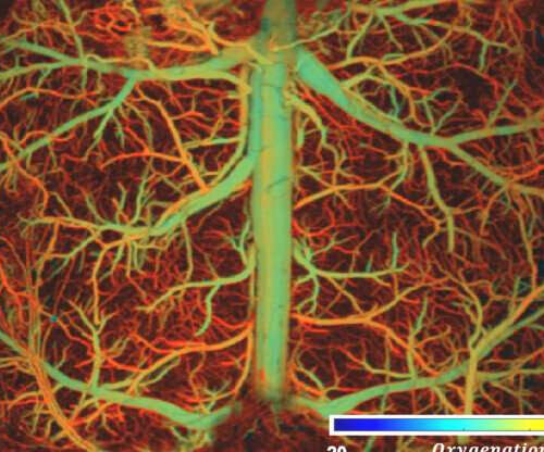 Using light and sound to reveal rapid brain activity in unprecedented detail