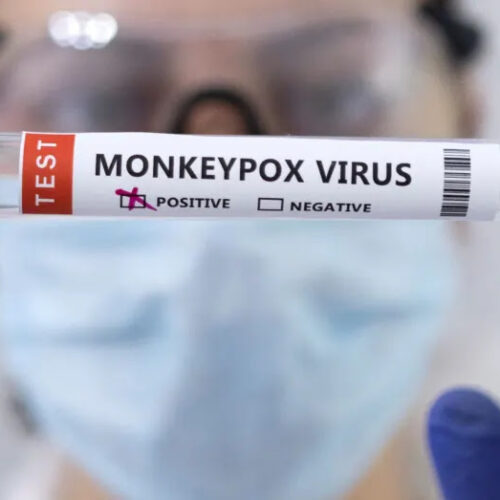 How to protect yourself against monkeypox and what to do if you catch it