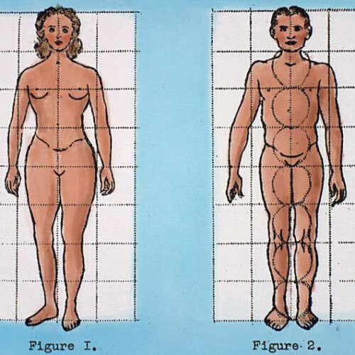 DNA sites linked with physical differences between sexes now also linked to disease risk