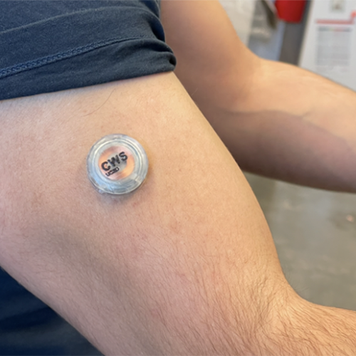 Wearable Uses Microneedles to Track Metabolism