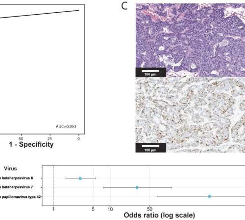 New method can easily identify viruses in tumors in a routine clinical genomic sequencing assay