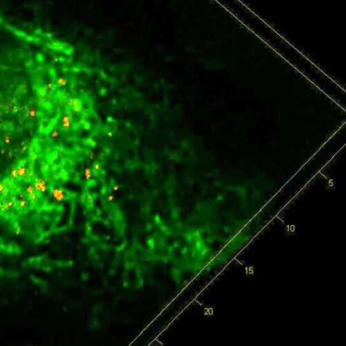 ‘Stressed’ cells offer clues to eliminating build-up of toxic proteins in dementia