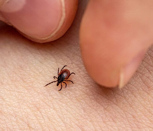 How to Remove a Tick Head the Right Way