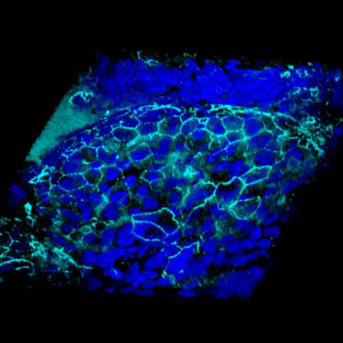 Cystic fibrosis: Restoring airway integrity