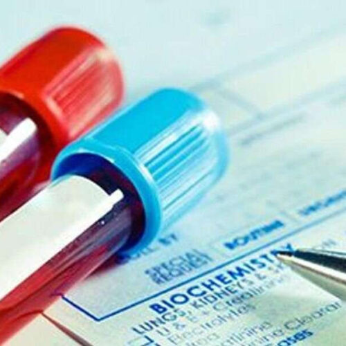 Using new guidelines would increase diabetes screening eligibility