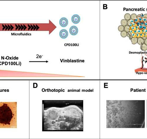 New research pushes closer to novel therapy for pancreatic cancer