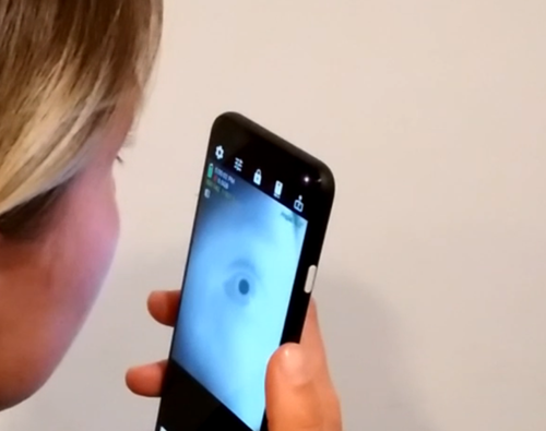 ‘Eye-catching’ smartphone app could make it easy to screen for neurological disease at home