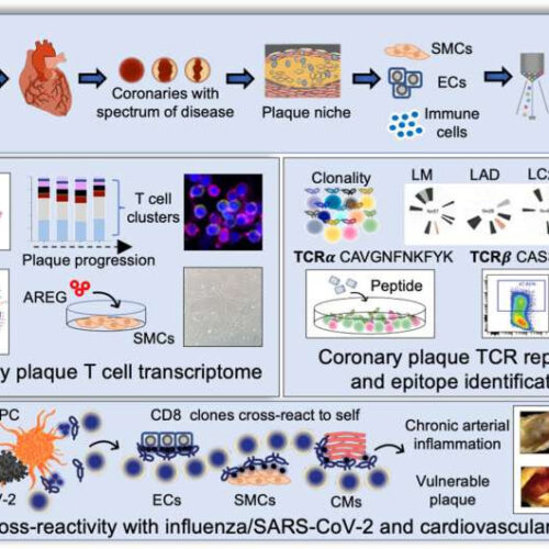 Heart artery plaque immune cells cross-react with virus and vascular proteins, a potential cause of heart attack