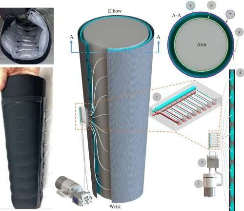 Wearable, inexpensive robotic sleeve for lymphedema treatment