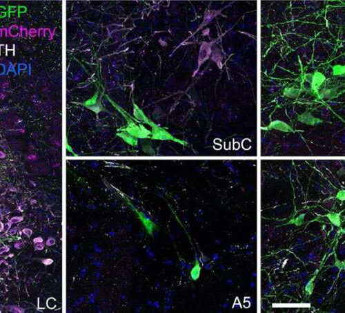 Scientists detail brain dynamics implicated in neurological conditions