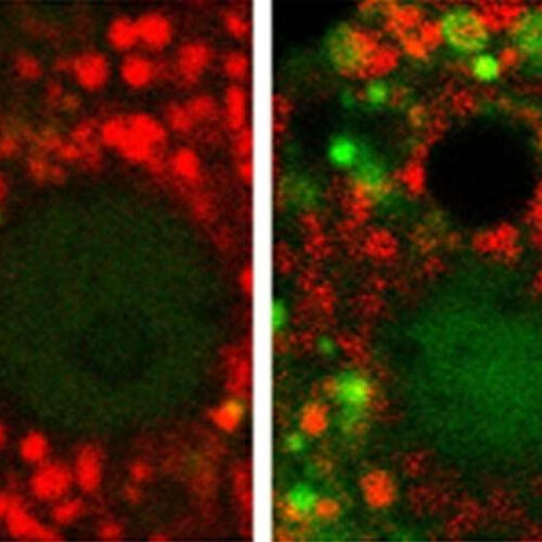 Excessive degradation of mitochondria is the tipping point from normal alcohol metabolism to alcoholic liver disease