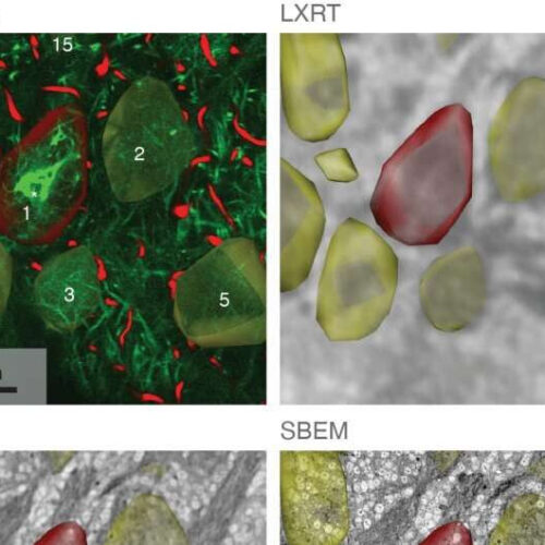 Scientists build subcellular map of entire brain networks