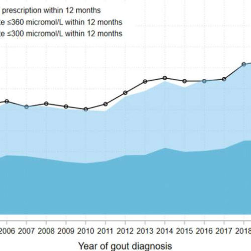 Just one in three people with gout prescribed preventative medication