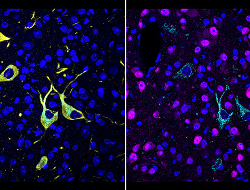 New technique shows in detail where drug molecules hit their targets in the body