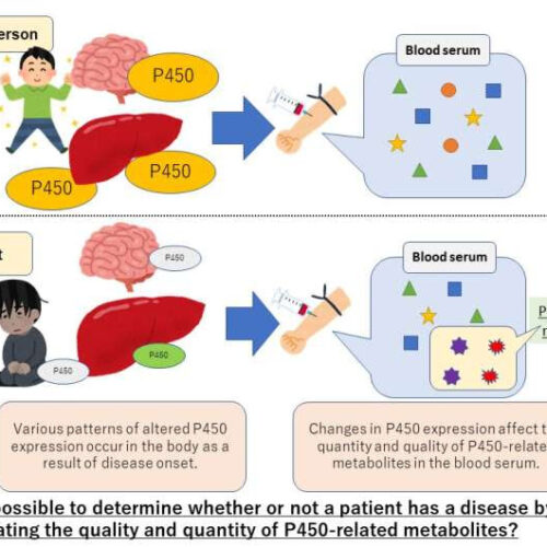 World-first: A biomarker that can diagnose Parkinson’s disease