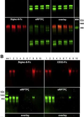 Researchers link sugar-studded protein to Alzheimer’s disease