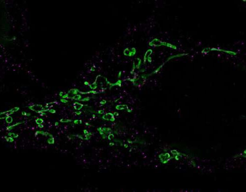 How herpesviruses awaken