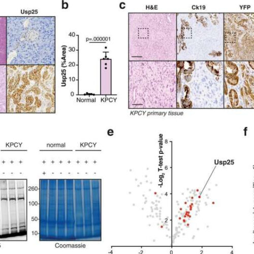 Drugs targeting cell recycling could be used to suffocate cancer cells