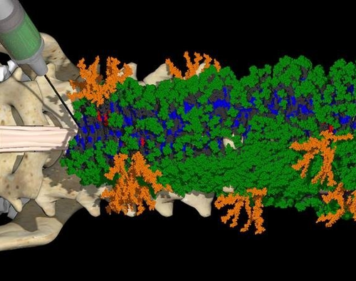 Fixing spinal cord injuries with ‘dancing molecules’