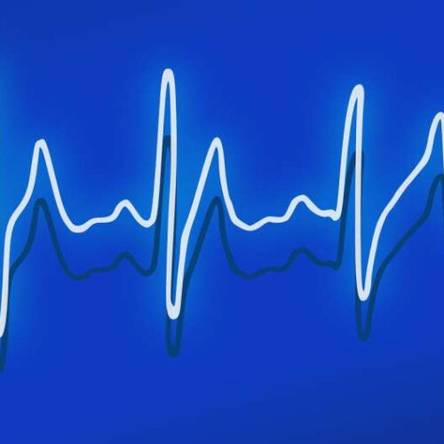 Spiral wave teleportation theory offers new path to defibrillate hearts, terminate arrhythmias