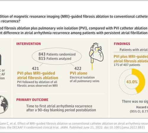 Global atrial fibrillation study finds simple ablation has best outcomes