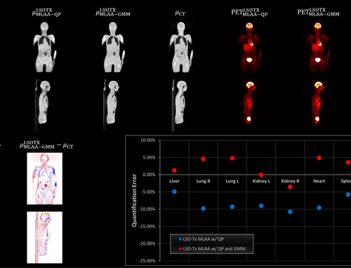 Novel ultra-low dose PET technique significantly reduces radiation exposure