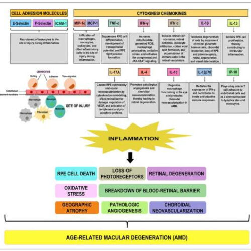 Researchers make a novel discovery in age-related macular degeneration