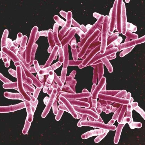 New study reveals hundreds of new drug targets to combat tuberculosis