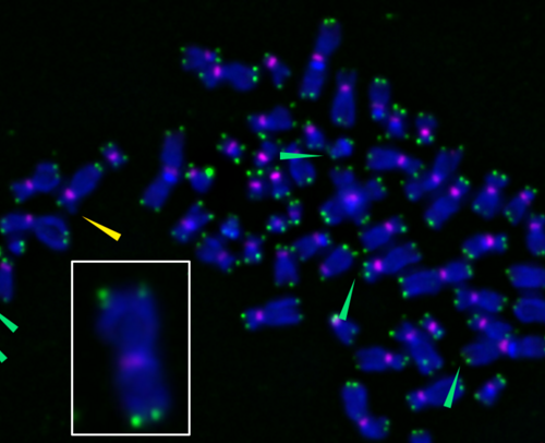 Researchers uncover new pathway for accumulation of age-promoting ‘zombie cells’